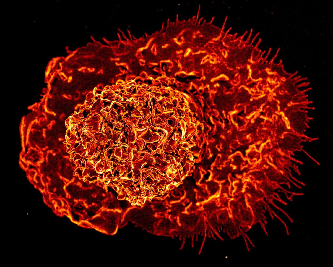 راز التهاب مزمن پیری فاش شد: کشف سلول ایمنی جدید