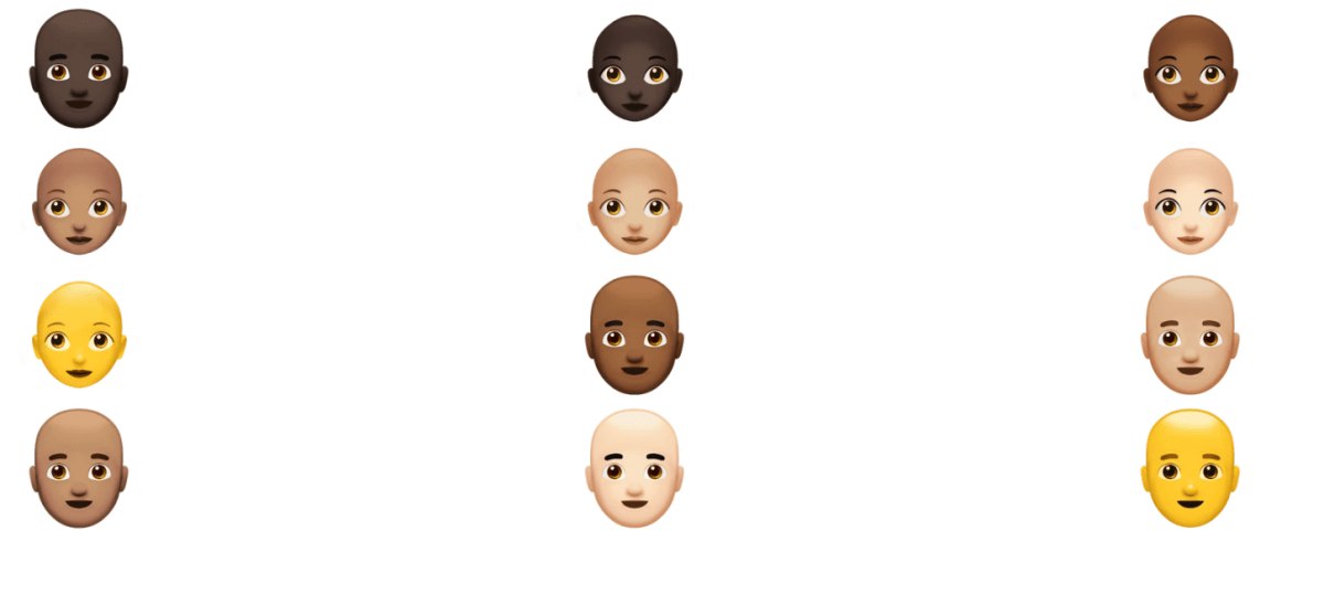 تشخیص ریزش مو با هوش مصنوعی از روی عکس‌های سر شما